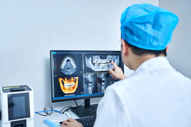 Best Emergency Wisdom Teeth Removal in Chester, MD