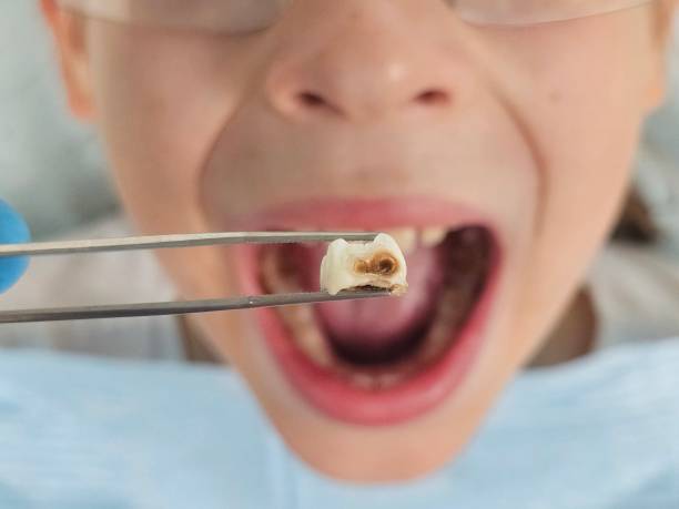 Best Emergency Denture Repair in Chester, MD
