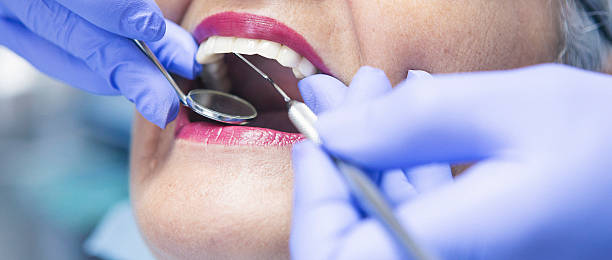 Best Emergency Treatment for Dental Infections or Abscesses in Chester, MD